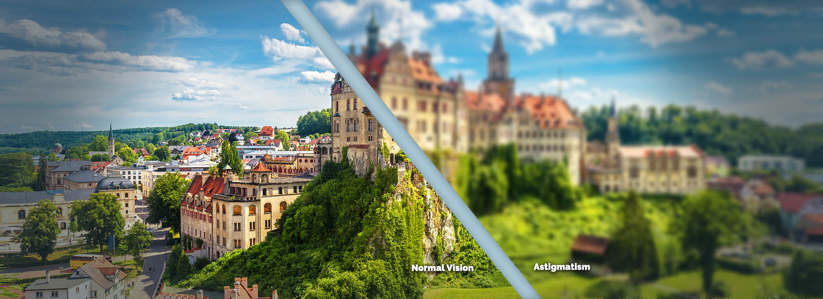 Astigmatism Treatment in Columbia