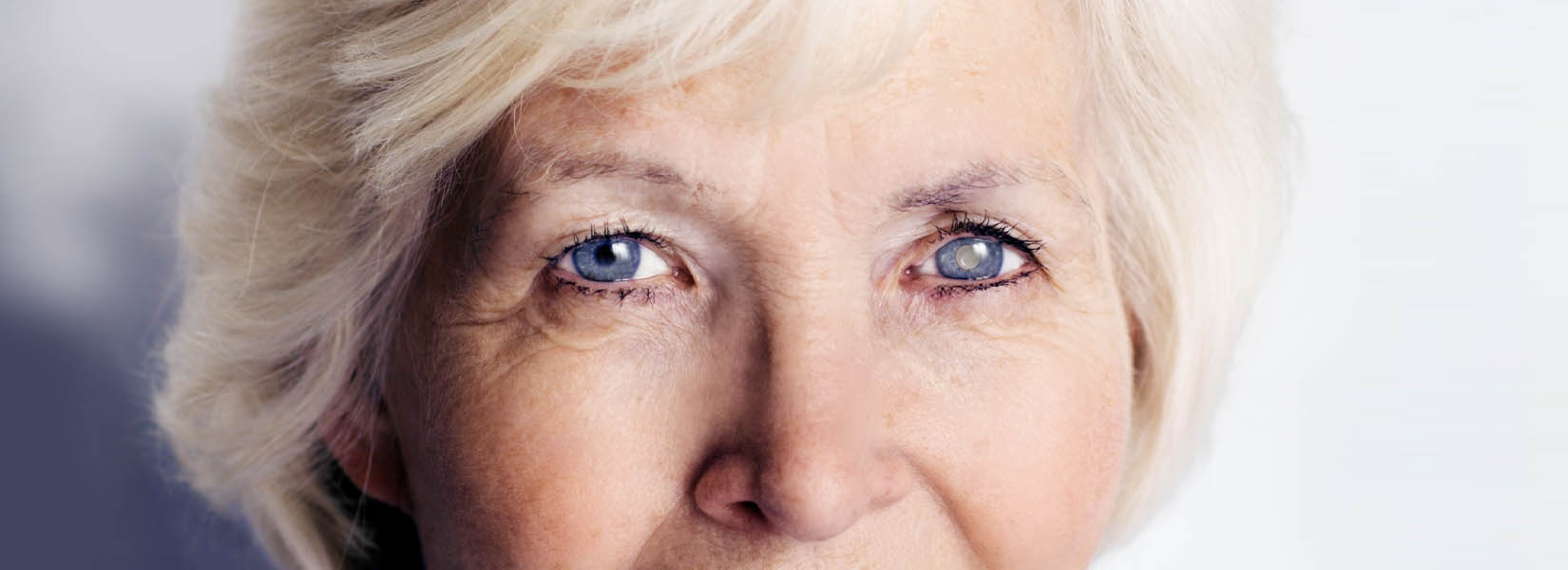 Cataract Surgery in Columbia